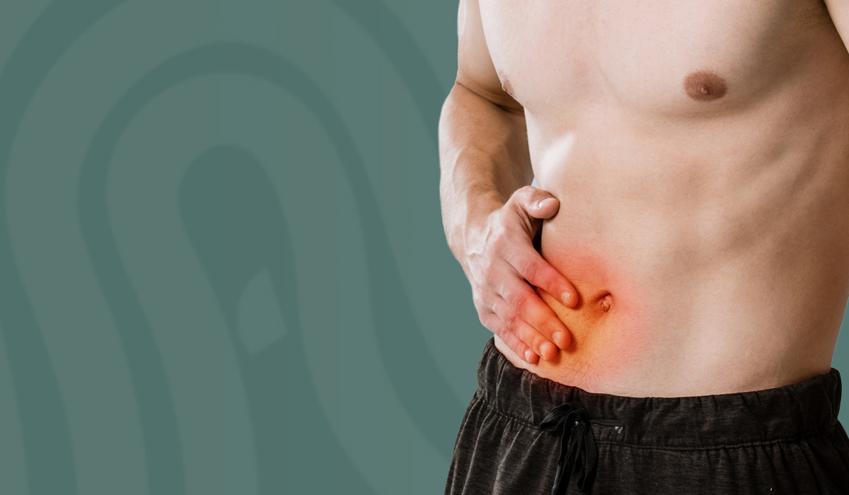 Cómo prevenir hernias abdominales