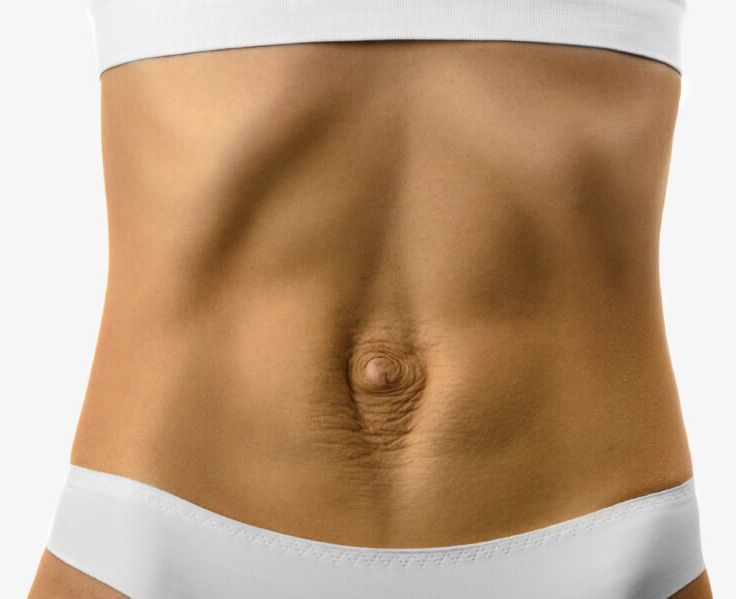 Dr. Álvaro Apéstegui, cirujano especialista en hernias de pared abdominal, Costa Rica