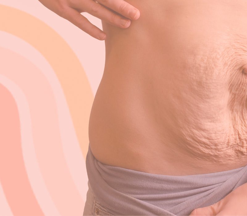 Dr. Álvaro Apéstegui, cirujano especialista en hernias de pared abdominal, Costa Rica