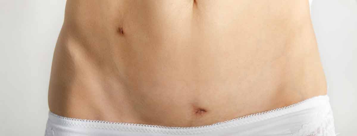 Cirugía Mínimamente Invasiva en la Diástasis de Rectos: La Revolución en la Reparación Abdominal