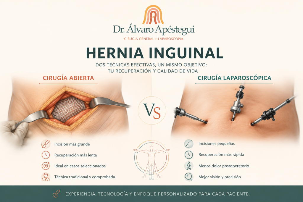 Hernia inguinal cirugía abierta o laparoscopica - Dr. Álvaro Apéstegui, Cirugía General y Pared Abdominal